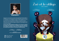 Zoe et le Vitiligo